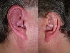 وقتی گوش می تواند سرنخ هایی از وضعیت سلامت بدهد